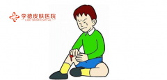 李德醫(yī)院提醒：皮膚外傷竟然會引發(fā)白癜風(fēng)！